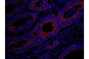 Immunofluorescence (IF) image for anti-MAP-Kinase Activating Death Domain (MADD) (AA 1597-1647) antibody (ABIN7448984)