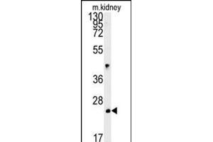 LHPL3 Antibody (C-term) (ABIN651908 and ABIN2840448) western blot analysis in mouse kidney tissue lysates (15 μg/lane). (LHFPL3 antibody  (C-Term))