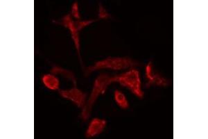 ABIN6278321 staining  COLO205 cells by IF/ICC. (SPTBN1 antibody  (N-Term))