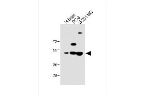 All lanes : Anti-M1 Antibody (Center) at 1:1000 dilution Lane 1: Human brain lysate Lane 2: PC-3 whole cell lysate Lane 3: U-251 MG whole cell lysate Lysates/proteins at 20 μg per lane. (AP1M1 antibody  (AA 205-234))