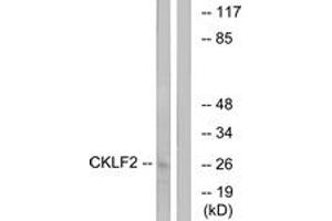 Western Blotting (WB) image for anti-CKLF-Like MARVEL Transmembrane Domain Containing 2 (CMTM2) (AA 171-220) antibody (ABIN2890220) (CMTM2 antibody  (AA 171-220))