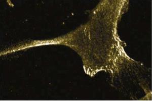 Immunofluorescent staining of Human Fibroblasts with anti-E-Cadherin antibody. (E-cadherin antibody  (AA 735-883))