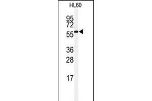 Western blot analysis of anti-SENP2 Antibody (C-term) (ABIN388045 and ABIN2845577) in HL60 cell line lysates (35 μg/lane). (SENP2 antibody  (C-Term))