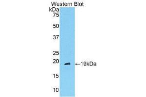 Western Blotting (WB) image for anti-Angiopoietin 1 (ANGPT1) (AA 304-450) antibody (ABIN3209767) (Angiopoietin 1 antibody  (AA 304-450))