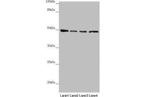 Western blot All lanes: AP1M1 antibody at 1. (AP1M1 antibody  (AA 1-160))