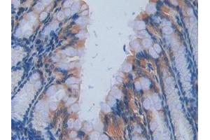 Detection of IL17RA in Mouse Intestine Tissue using Polyclonal Antibody to Interleukin 17 Receptor A (IL17RA) (IL17RA antibody  (AA 590-848))