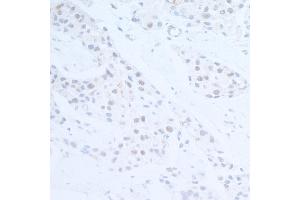 Immunohistochemistry (IHC) image for anti-Ubiquitin Protein Ligase E3 Component N-Recognin 5 (UBR5) (AA 600-650) antibody (ABIN7454646)
