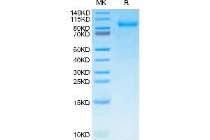 CSF3R Protein (AA 25-627) (His tag)