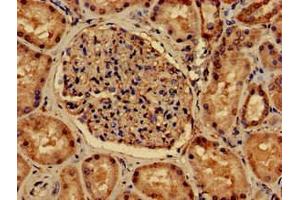 Immunohistochemistry of paraffin-embedded human kidney tissue using ABIN7162722 at dilution of 1:100 (PDLIM2 antibody  (AA 161-284))
