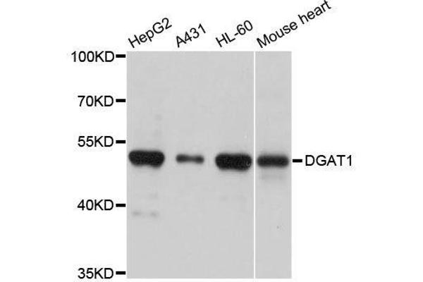 DGAT1 anticorps  (AA 200-300)