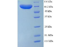 SDS-PAGE (SDS) image for Peptidyl Arginine Deiminase, Type I (PADI1) (AA 1-663), (full length) protein (His tag) (ABIN4975886) (PADI1 Protein (AA 1-663, full length) (His tag))