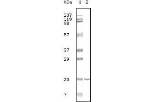 Western blot analysis using CD19 mouse mAb against CD19 recombinant protein. (CD19 antibody)
