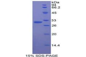 SDS-PAGE analysis of Human Karyopherin alpha 2 Protein. (KPNA2 Protein)