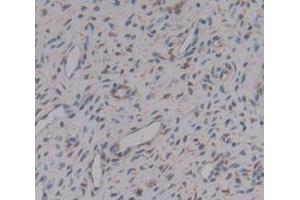 Figure. (OGN antibody  (AA 180-298))