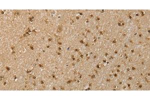 Immunohistochemistry of paraffin-embedded Human brain using RNH1 Polyclonal Antibody at dilution of 1:40 (RNH1 antibody)