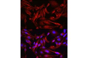Immunofluorescence analysis of U2OS cells using ST Rabbit pAb (ABIN6128541, ABIN6148581, ABIN6148582 and ABIN6213980) at dilution of 1:200 (40x lens). (STAT6 antibody  (AA 1-180))