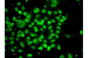 Immunofluorescence analysis of A-549 cells using SMYD3 antibody (ABIN6128709, ABIN6148169, ABIN6148170 and ABIN6223146). (SMYD3 antibody  (AA 140-369))
