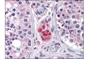 Immunohistochemistry Image: Human Testis: Formalin-Fixed, Paraffin-Embedded (FFPE) (PPARD antibody  (C-Term))