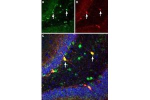 Multiplex staining of ASIC1 and parvalbumin in rat hippocampusImmunohistochemical staining of immersion-fixed, free floating rat brain frozen sections using Guinea pig Anti-ASIC1 Antibody (ABIN7042914, ABIN7045410 and ABIN7045411), (1:300). (Amiloride-Sensitive Cation Channel 2, Neuronal (ACCN2) Peptide)