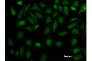 Immunofluorescence of monoclonal antibody to FH on HeLa cell. (FH antibody  (AA 33-510))