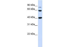 WB Suggested Anti-CTNNB1 Antibody Titration: 0. (CTNNB1 antibody  (C-Term))