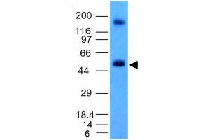 Image no. 2 for anti-Carbonic Anhydrase IX (CA9) antibody (ABIN6182201) (CA9 antibody)