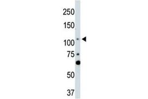 Western Blotting (WB) image for anti-LATS, Large Tumor Suppressor, Homolog 2 (Drosophila) (LATS2) (AA 228-258) antibody (ABIN3031595)
