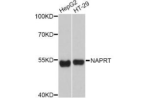 Western blot analysis of extracts of various cell lines, using NAPRT Antibody (ABIN4904492) at 1:3000 dilution. (NAPRT1 antibody)