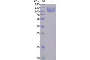 Human CD155 Protein, hFc Tag on SDS-PAGE under reducing condition. (Poliovirus Receptor Protein (PVR) (Fc Tag))