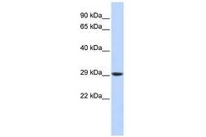 Image no. 1 for anti-Proteasome Subunit Alpha Type 3 (PSMA3) (C-Term) antibody (ABIN6744210) (PSMA3 antibody  (C-Term))