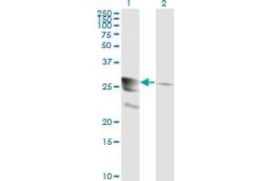Western Blotting (WB) image for anti-GTP Cyclohydrolase 1 (GCH1) (AA 84-172) antibody (ABIN561018)