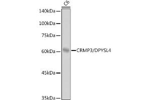 Western blot analysis of extracts of C6 cells, using CRMP3/DPYSL4 antibody (ABIN7266772) at 1:1000 dilution. (DPYSL4 antibody)
