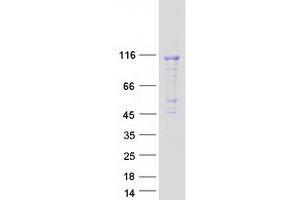 DENND1C Protein (Myc-DYKDDDDK Tag)