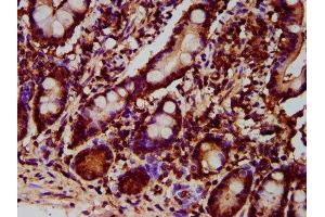 IHC image of ABIN7143620 diluted at 1:700 and staining in paraffin-embedded human small intestine tissue performed on a Leica BondTM system.