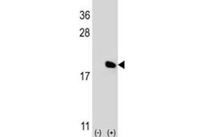 Western blot analysis of IL-17 antibody and 293 cell lysate (2 ug/lane) either nontransfected (Lane 1) or transiently transfected (2) with the IL17A gene. (Interleukin 17a antibody  (AA 61-87))