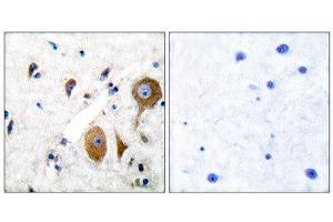 Immunohistochemistry (IHC) image for anti-Glutamate Receptor, Metabotropic 8 (GRM8) (C-Term) antibody (ABIN1848580) (GRM8 antibody  (C-Term))