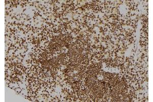 ABIN6260675 and ABIN6276576 at 1/100 staining Rat spleen tissue by IHC-P. (CDC25A antibody  (N-Term))