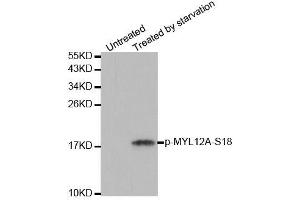Western blot analysis of extracts from 293 cells untreated or treated with starvation using Phospho-MYL12A-S18 antibody (ABIN2988196). (MYL12A antibody  (pSer18))
