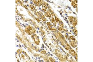 Immunohistochemistry of paraffin-embedded human stomach using BMP15 antibody at dilution of 1:100 (x40 lens).