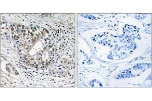 Immunohistochemistry (IHC) image for anti-Polyribonucleotide Nucleotidyltransferase 1 (PNPT1) (AA 570-619) antibody (ABIN6767063) (PNPT1 antibody  (AA 570-619))