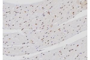 ABIN6257188 and ABIN6274272 at 1/100 staining Mouse heart tissue by IHC-P.