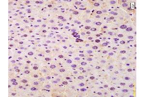 Formalin-fixed and paraffin embedded mouse liver labeled with Anti-SRRM2 Polyclonal Antibody, Unconjugated  at 1:200 followed by conjugation to the secondary antibody and DAB staining.