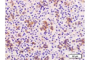 Formalin-fixed and paraffin embedded human pancreas labeled with Anti-TROP2/TACD2 Polyclonal Antibody, Unconjugated (ABIN715646) at 1:200 followed by conjugation to the secondary antibody and DAB staining (TACSTD2 antibody  (AA 221-322))
