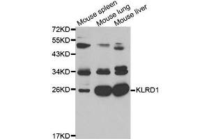 Western blot analysis of extracts of K562 cell lines, using KLRD1 antibody. (CD94 antibody  (AA 32-179))