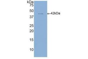 WB of Protein Standard: different control antibodies  against Highly purified E. (CD4 ELISA Kit)