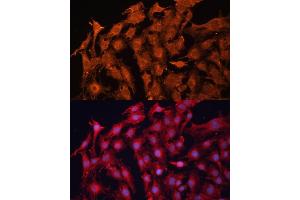 Immunofluorescence analysis of C6 cells using P Glycoprotein antibody (ABIN6129943, ABIN6136341, ABIN6136344 and ABIN6216612) at dilution of 1:100. (ABCB1 antibody  (AA 630-710))
