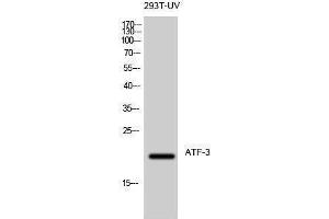 Western Blotting (WB) image for anti-Activating Transcription Factor 3 (ATF3) (C-Term) antibody (ABIN3183418) (ATF3 antibody  (C-Term))