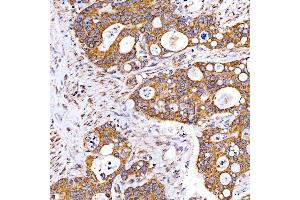 IHC analysis of Rab4/RAB4A using anti-Rab4/RAB4A antibody (ABIN7599733). (Rab4 antibody  (AA 110-216))