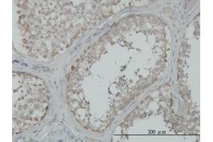 Image no. 1 for anti-Mitogen-Activated Protein Kinase Kinase Kinase 4 (MAP3K4) (AA 1201-1300) antibody (ABIN598811) (MAP3K4 antibody  (AA 1201-1300))