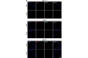 Immunofluorescence (Cultured Cells) (IF (cc)) image for anti-Histone H2A Variant (HIS2AV) (Internal Region), (pSer137) antibody (ABIN129671)